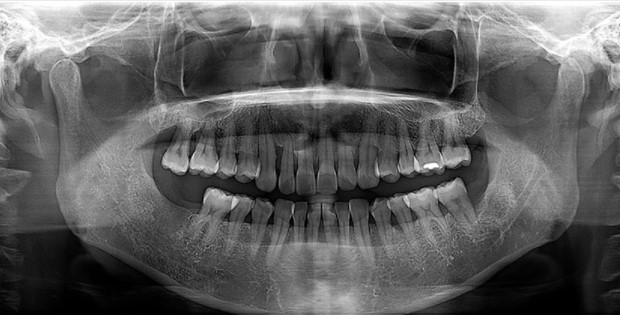 https://edgewater-dentist.com/wp-content/uploads/2021/11/Digital-Xray-2.jpg