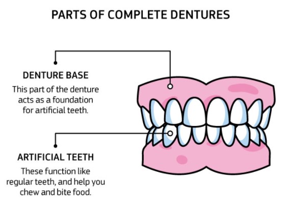 https://edgewater-dentist.com/wp-content/uploads/2021/12/Full-Dentures-1.jpg