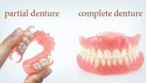 https://edgewater-dentist.com/wp-content/uploads/2021/12/Partial-Denture-3.jpg